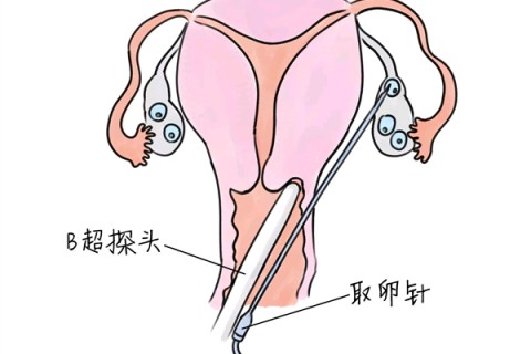 http://shenzhen.vdtfzz.com/post/205.html|深圳供卵助孕