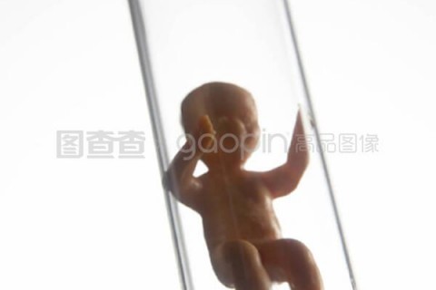 http://shenzhen.vdtfzz.com/post/197.html|深圳试管助孕